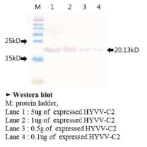 토마토황화잎말림바이러스 시2유전자의 대장균내 발현 및 재조합 시2단백질에 대한 다클론항체 생산법 Expression of Tomato yellow leaf curl virus(TYLCV)-C2 gene in Escherichia coli and production of polyclonal antibody against the recombinant TYLCV-C2 protein