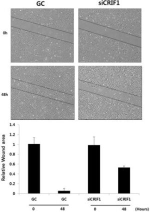 세포이동 촉진제 또는 억제제의 스크리닝 방법
