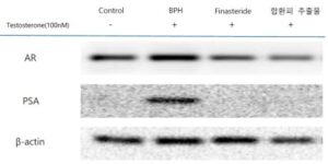 합환피 추출물을 함유하는 전립선 질환의 예방 및 치료용 조성물