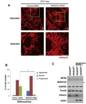 근위축성 측색경화증의 예방 또는 치료용 조성물 및 진단방법