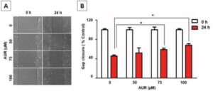 아우랍텐을 포함하는 신장암의 예방 또는 치료용 조성물