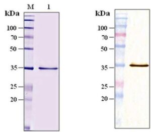 마이코박테리움 압세수스의 ＭＡＢ０９８１ｃ 단백질을 이용한 수지상 세포의 성숙방법