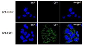 퇴행성 뇌질환 치료용 후보약물의 스크리닝 방법