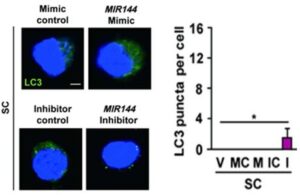 자가포식 조절제의 스크리닝 방법