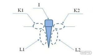 이중 에너지 원리를 이용한 임플란트 잇몸조직 ＣＴ영상 해석방법