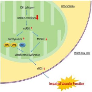 이소시트릴산 탈수소화효소 2를 포함하는 혈관 질환 진단용 바이오 마커 조성물