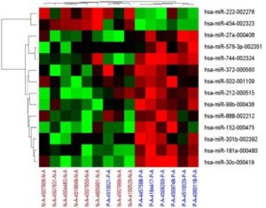 동맥경화증 진단용 바이오 마커 조성물