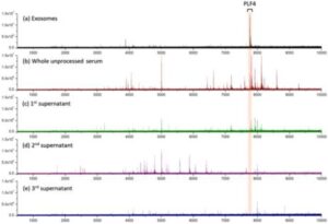 엑소좀 검출 및 간질환 진단을 위한 분석 방법